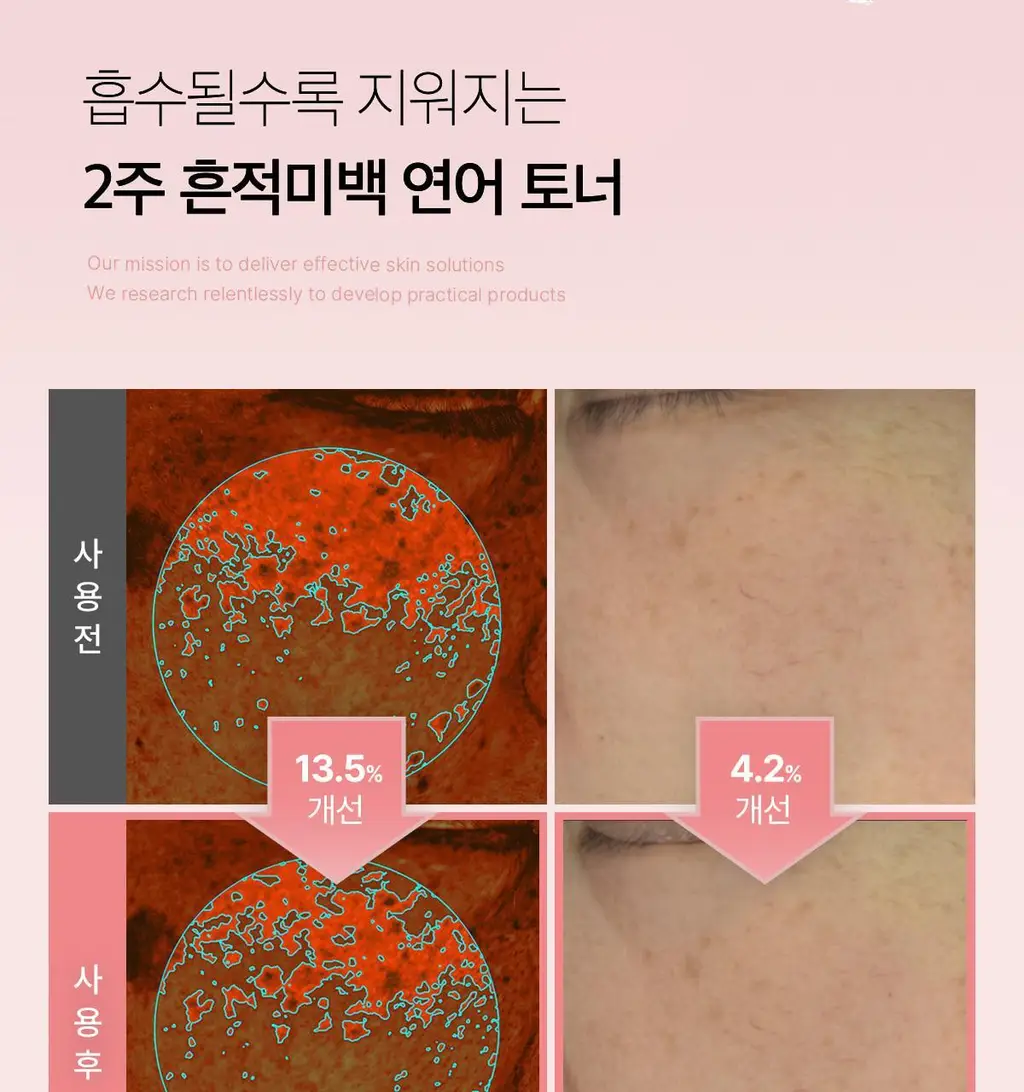 [흔적미백]메디큐브 PDRN 핑크 시카 수딩 토너 250ml 상세페이지 14
